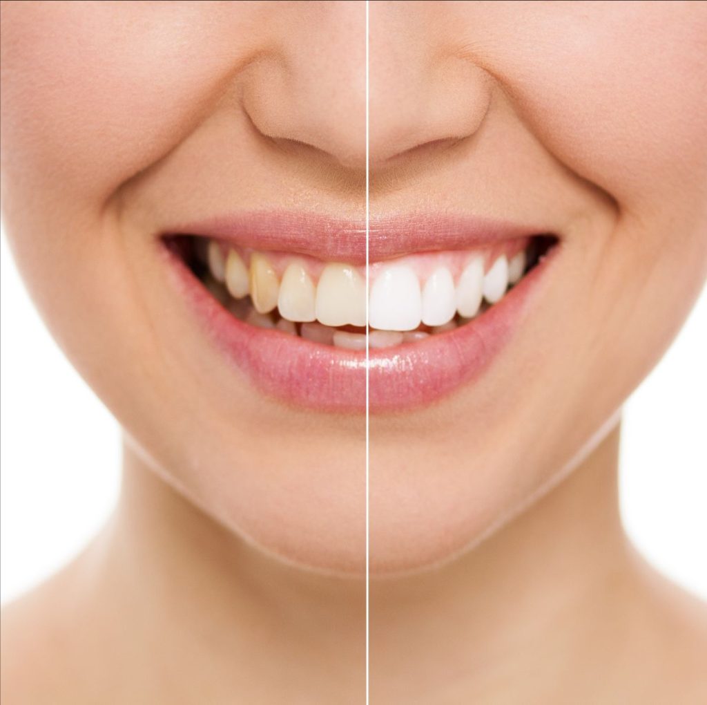 Cosmetic dentistry | Fit City