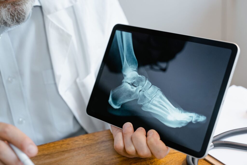 An orthopedics doctor holding an x-ray image of a foot up to view